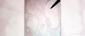 Sebaceous glands facts