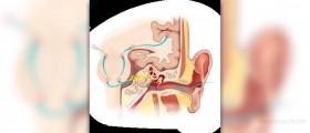 Sensorineural deafness causes