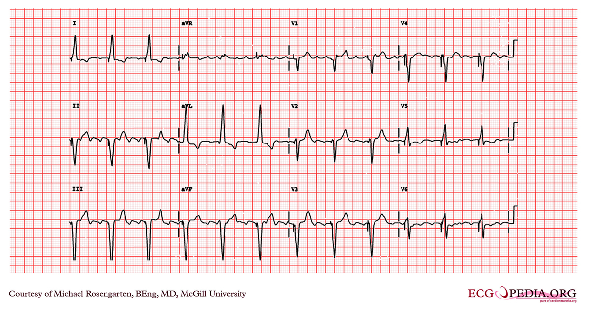 Understanding cardiogenic shock | General center | SteadyHealth.com