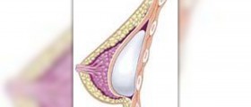 Shooting pain in breast