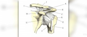Shoulder impingement surgery