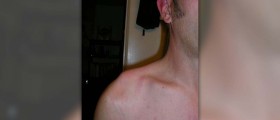 Shoulder pain causes