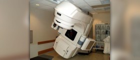 Side effects of radiation therapy