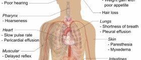 Hypothyroidism in men