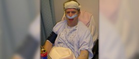 Sinus surgery procedure