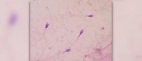 Sperm count - various facets