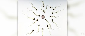 Different types of sperm washing which do you need?
