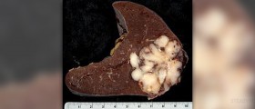 Spleen function in immune system
