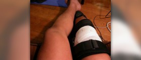 Sprained knee treatment