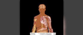 Stem cell - Future of plastic surgery