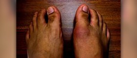 Stinky feet facts