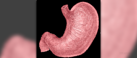 Stomach and back pain