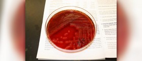 Group B streptococcus screening and testing