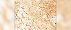 Subcutaneous fat facts