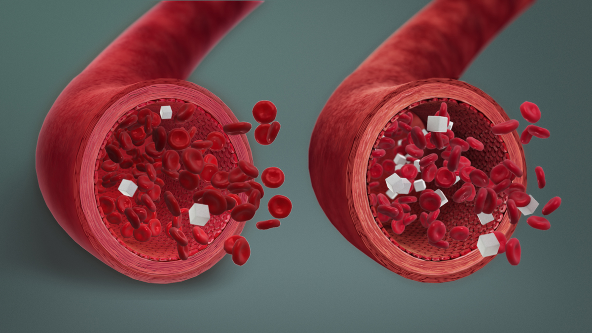 symptoms-of-hypoglycemia-general-center-steadyhealth