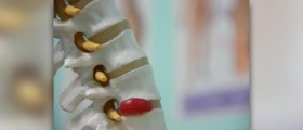 Surgery for bulging disc