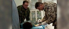 Surgery for burns