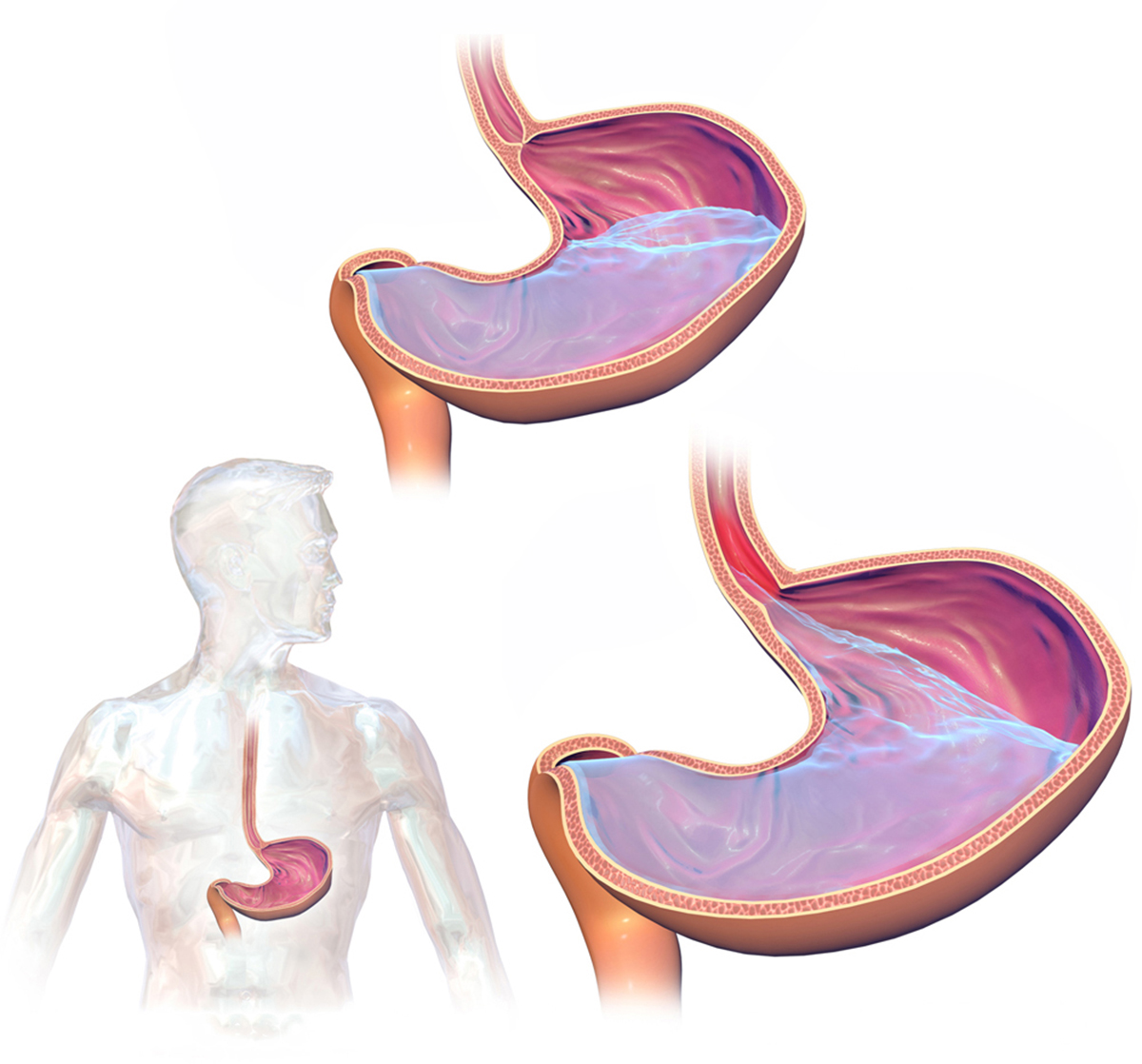 Surgery for esophageal cancer General center