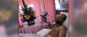 Surgery for hyperhidrosis