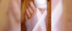 Surgery for ingrown toenails