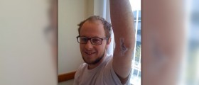 Surgery for tennis elbow