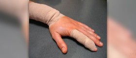 Surgery for trigger finger