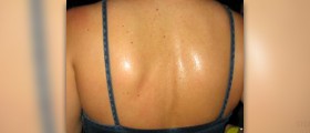 Sweating at night causes
