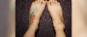 Swollen ankles as a pregnancy symptom