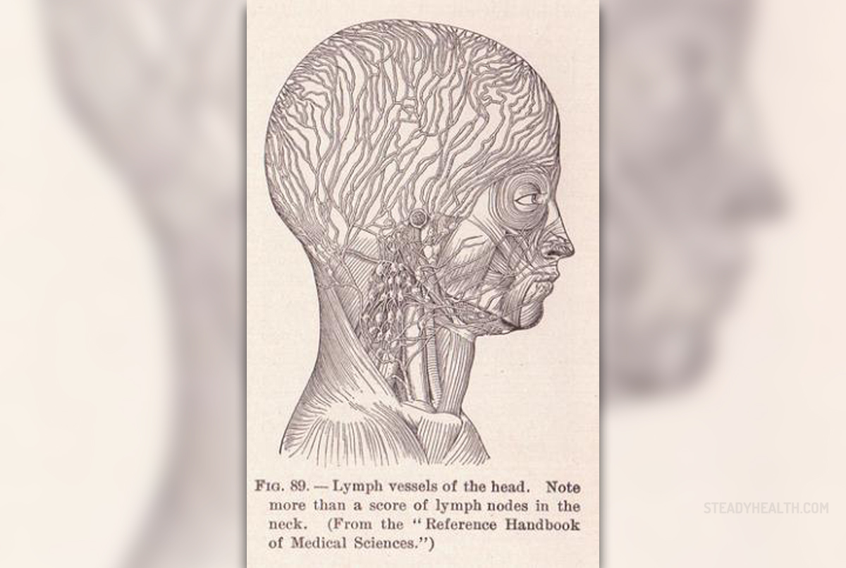 moderna side effect swollen lymph nodes