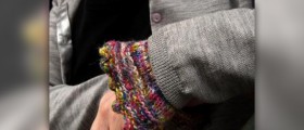 Swollen wrist treatment