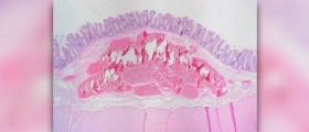 Symptoms of bowel problems