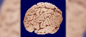 Symptoms of brain injury