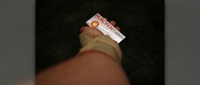 Symptoms of carpal tunnel syndrome