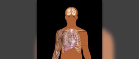Symptoms of heat stroke