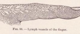 Symptoms of lymphedema