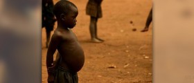 Symptoms of malnutrition