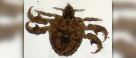 Symptoms of pubic lice