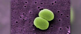 Symptoms of staphylococcus aureus