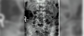 Tailbone pain when sitting