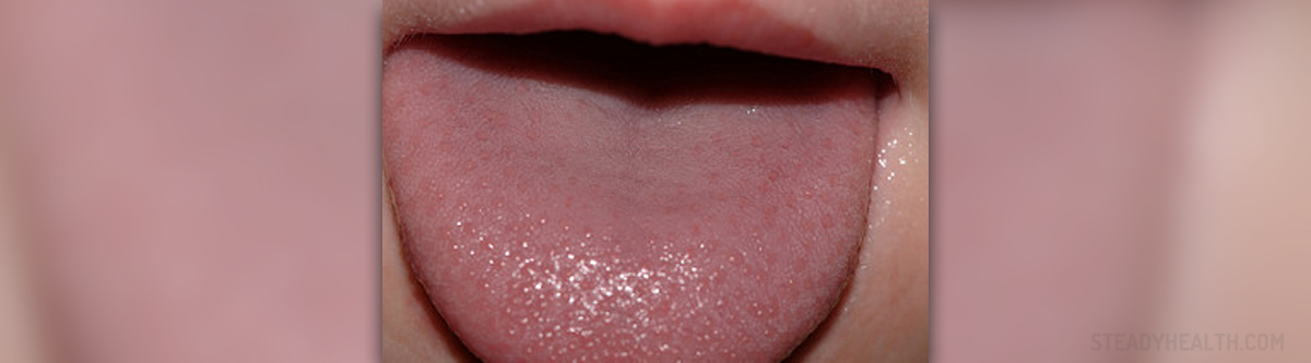 Swollen Taste Buds Lasopaassociates   Taste Buds Close Up 