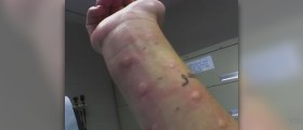 The cause of allergies - a spiritual perspective