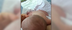 The connection between thrush and diaper rash