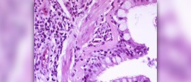 The difference between asthma and bronchitis