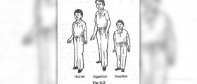 Therapy for gigantism