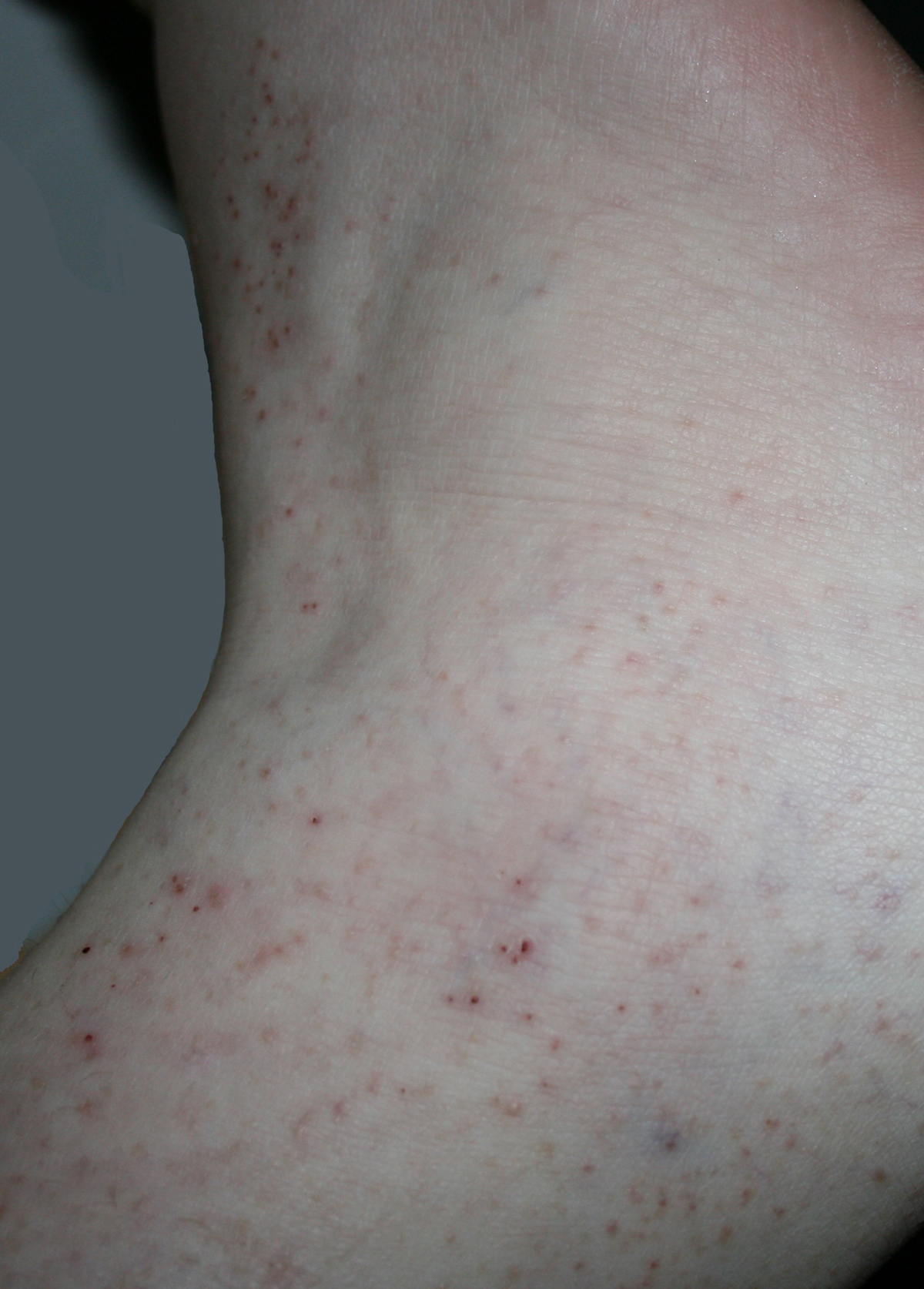 Therapy for gout General center