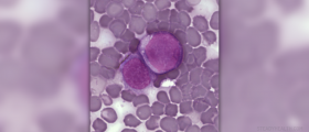 Therapy for leukemia
