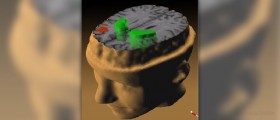 Therapy for paranoid schizophrenia