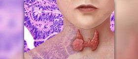Prevention of myxedema coma