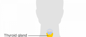 Thyroid gland disorders