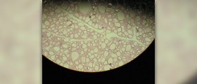 Thyroid gland problems